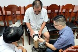 Bảo dưỡng, sửa chữa chân, tay giả cho người có công với cách mạng