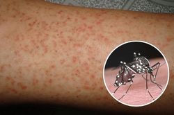 Sốt xuất huyết gia tăng, người dân Hà Nội không nên chủ quan