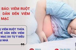 3 trẻ bị vỡ ruột thừa biến chứng viêm phúc mạc vì gia đình chủ quan tự điều trị khi đau bụng