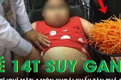Bé gái 14 tuổi nặng 70 kg bị suy gan cấp