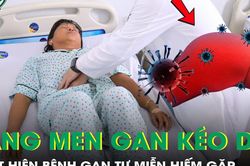Ngứa da kéo dài, người phụ nữ 57 tuổi phát hiện bệnh gan tự miễn hiếm gặp