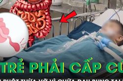 3 trẻ phải cấp cứu vì viêm ruột thừa vỡ