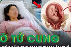 Cấp cứu kịp thời sản phụ mang thai lần thứ 7 vỡ tử cung
