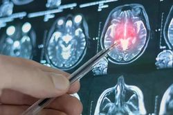 AI Trung Quốc có thể dự báo nguy cơ trầm cảm trước 4 năm chỉ từ cách nhìn khuôn mặt
