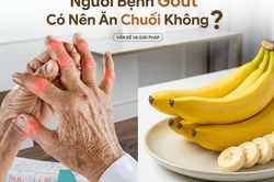 Người bệnh gout có nên ăn chuối không?