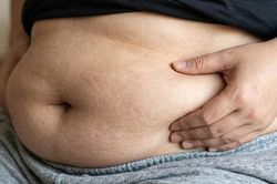 Vì sao người thức khuya hay bị tích mỡ bụng?