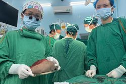 Lấy trọn khối u quái nặng 1,3 kg cho bé gái 5 ngày tuổi