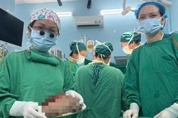Bé 5 ngày tuổi có khối u quái nặng 1,3 kg