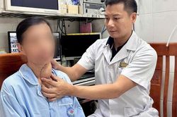 10 năm không điều trị, bướu giáp phát triển khổng lồ chèn ép khí quản