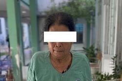 Thay khớp gối toàn phần thành công cho ca bệnh thoái hóa và vẹo trục nặng
