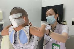 Bé gái 27 tháng tuổi nguy kịch sau cú ngã đập đầu, dấu hiệu ban đầu dễ bị bỏ qua