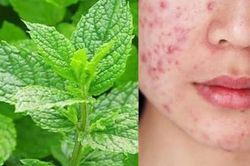 Da mụn nên ăn rau gì cho mát? Mẹo làm đẹp da đơn giản từ các loại rau quen thuộc