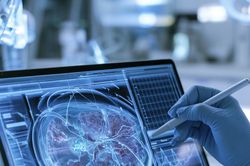 AI y tế hỗ trợ chẩn đoán bệnh nhưng không thay thế bác sĩ đưa ra quyết định