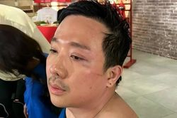 Trấn Thành chỉ ngủ 12 phút/ngày