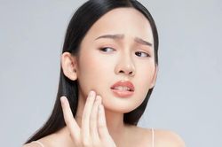 Làm thế nào để xử lý hiệu quả mụn ẩn viêm hay những nốt mụn 'nằm lì' dưới da?