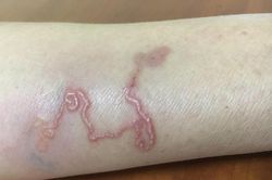 Loại giun có thể ngủ quên hàng chục năm rồi bất ngờ bùng phát