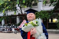 Chàng trai bạch tạng và hành trình chạm tới ước mơ