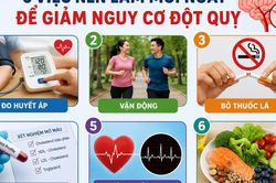 Phòng ngừa đột quỵ ở người có HIV mắc tăng huyết áp