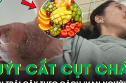 Người phụ nữ 40 tuổi suýt phải cắt cụt chân vì ăn trái cây theo cách này