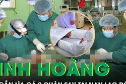 Người đàn ông 59 tuổi bị đứt gần lìa cả hai chân sau tai nạn