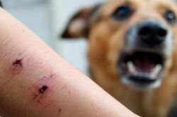 Bộ Y tế: Tăng cường giám sát, hạn chế thấp nhất ca tử vong do bệnh dại