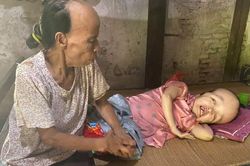 Mẹ 70 tuổi chống nạng chăm con liệt giường hơn 30 năm, sợ ngày không còn sức