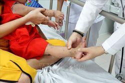 Bộ Y tế cảnh báo gia tăng bệnh tay chân miệng đầu năm học mới