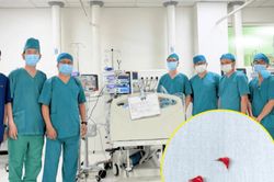 Hai bệnh viện phối hợp lấy thành công 3 mảnh xương lươn cho bé 7 tháng tuổi