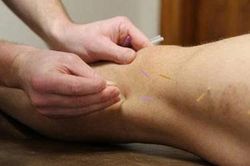 Ngồi lâu, ít vận động, bệnh suy giãn tĩnh mạch ngày càng phổ biến