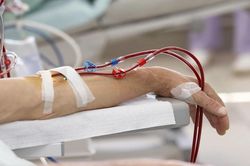 4 việc cần làm ngay để bảo vệ hai quả thận trước khi quá muộn