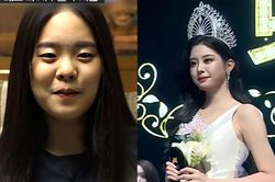 Tân Hoa hậu Hàn Quốc vướng nghi vấn phẫu thuật thẩm mỹ