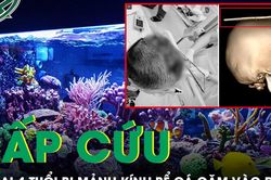 Bé trai 4 tuổi bị mảnh kính bể cá găm vào đầu