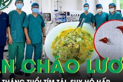 Bé 7 tháng tuổi tím tái, suy hô hấp sau khi ăn bát cháo lươn