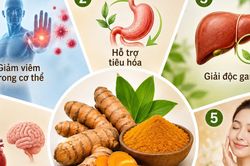 Nghệ có những lợi ích gì đối với sức khỏe?