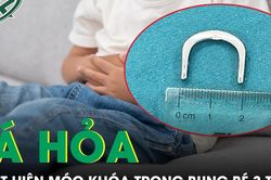Tá hỏa phát hiện chiếc móc khóa hình chữ C trong bụng bé 3 tuổi