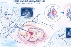 Thành phố Hồ Chí Minh thông tim bào thai ca thứ 15 thành công