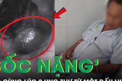 Người đ&agrave;n &ocirc;ng 55 tuổi 'sốc nặng' khi ph&aacute;t hiện mắc c&ugrave;ng l&uacute;c 2 ung thư