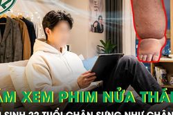 Nam sinh 22 tuổi nằm xem phim suốt nửa tháng, chân sưng như chân voi