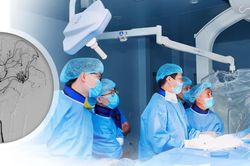 Hai trẻ xuất huyết não do dị dạng mạch máu được nút tắc thành công