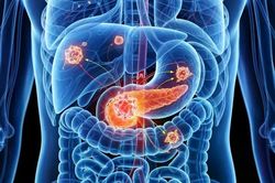 Mỹ phê duyệt thuốc điều trị ung thư tuyến tụy di căn