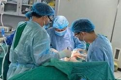 Khối u v&ugrave;ng k&iacute;n gần 20 cm sau nhiều năm giấu bệnh