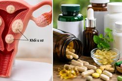Người bệnh u xơ tử cung nên thận trọng với những thực phẩm chức năng nào?