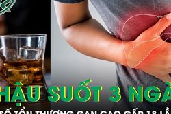Sau 3 ngày nhậu liên tục, chỉ số tổn thương gan tăng gấp 18 lần