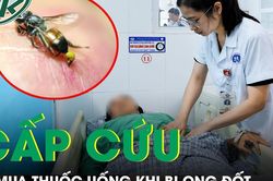 Bị ong đốt, người phụ nữ tự mua thuốc uống rồi nhập viện cấp cứu