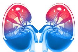 Viêm cầu thận: Nhận biết sớm để tránh biến chứng