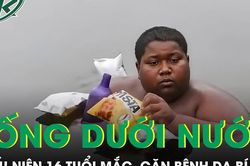 Thiếu niên 16 tuổi sống dưới nước như cá suốt 5 năm