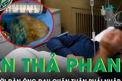 Vừa tán sỏi thận đã ăn mặn uống bia, người đàn ông đau quặn thận