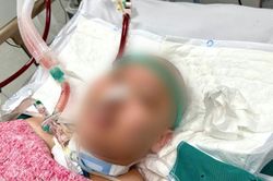 Nam thanh niên 25 tuổi suy đa tạng nguy kịch vì căn bệnh tự miễn