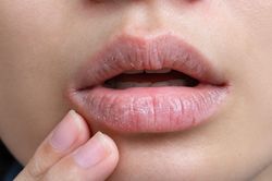 Dưỡng môi chăm chỉ nhưng miệng vẫn khô như sa mạc: Dấu hiệu 4 bệnh lý