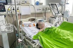 Cụ bà 70 tuổi nguy kịch sau cơn đau lưng, phát hiện huyết khối tắc hai động mạch phổi
